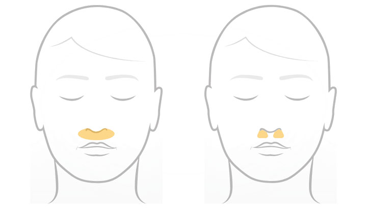 F&P Solo Mask Type F&P Solo Mask Type